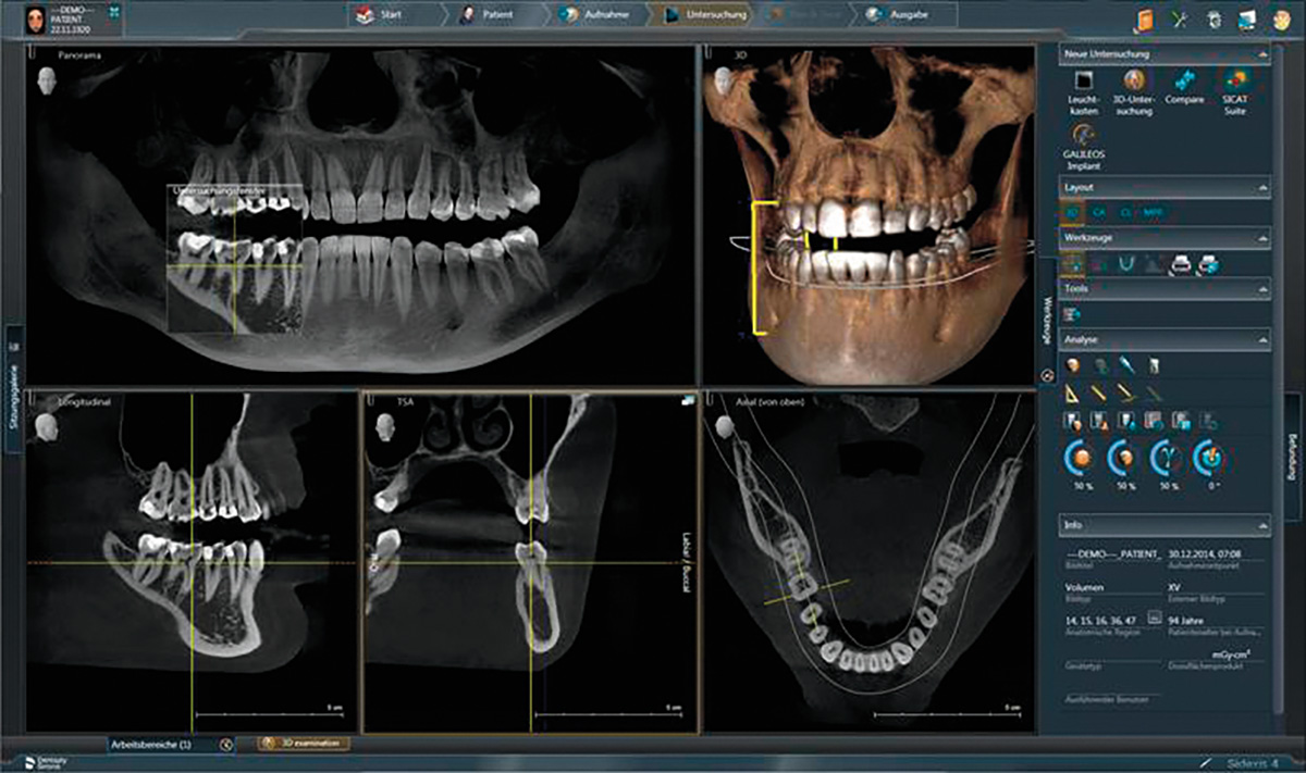3D-Roentgen